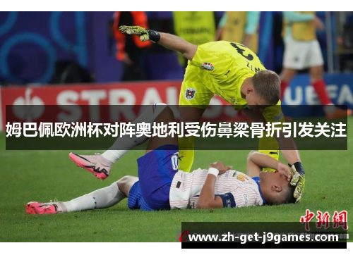 姆巴佩欧洲杯对阵奥地利受伤鼻梁骨折引发关注 姆巴佩欧洲杯对阵奥地利受伤鼻梁骨折引发关注